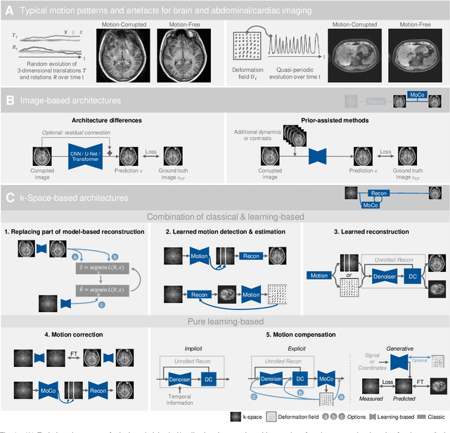 Figure 1 for Deep Learning for Retrospective Motion Correction in MRI: A Comprehensive Review