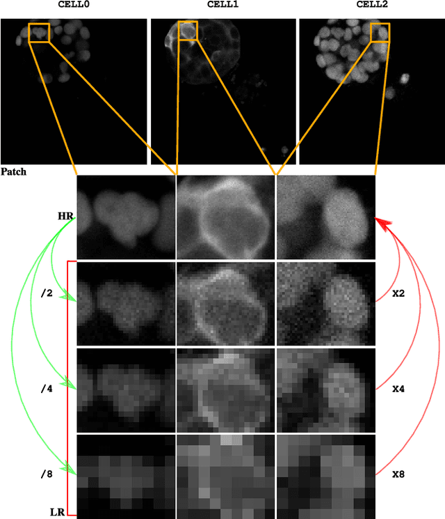 Figure 1 for SR-CACO-2: A Dataset for Confocal Fluorescence Microscopy Image Super-Resolution