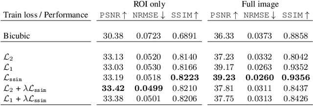 Figure 4 for SR-CACO-2: A Dataset for Confocal Fluorescence Microscopy Image Super-Resolution