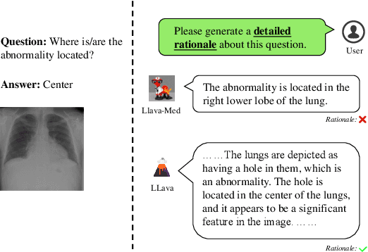 Figure 1 for MC-CoT: A Modular Collaborative CoT Framework for Zero-shot Medical-VQA with LLM and MLLM Integration