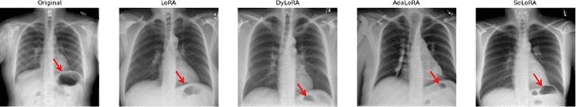 Figure 3 for SeLoRA: Self-Expanding Low-Rank Adaptation of Latent Diffusion Model for Medical Image Synthesis