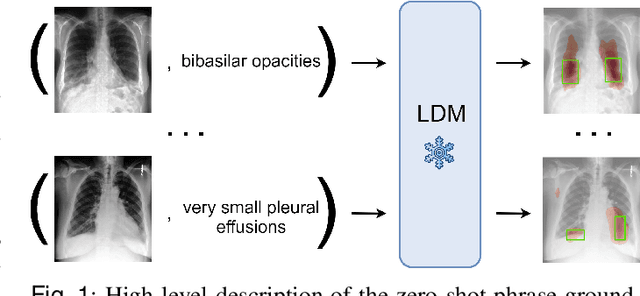 Figure 1 for Zero-Shot Medical Phrase Grounding with Off-the-shelf Diffusion Models