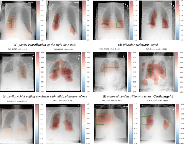 Figure 3 for Zero-Shot Medical Phrase Grounding with Off-the-shelf Diffusion Models