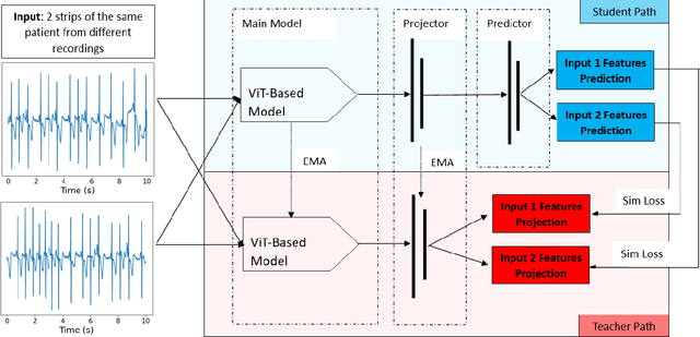 Figure 3 for Subject-based Non-contrastive Self-Supervised Learning for ECG Signal Processing