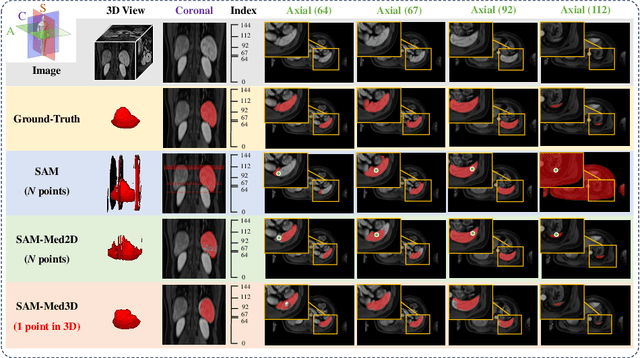 Figure 1 for SAM-Med3D