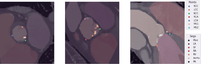 Figure 3 for Federated Foundation Model for Cardiac CT Imaging