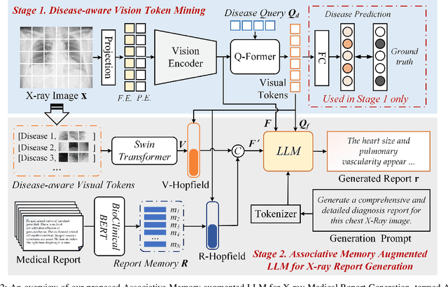 Figure 2 for Activating Associative Disease-Aware Vision Token Memory for LLM-Based X-ray Report Generation