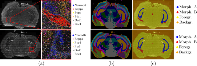 Figure 1 for Transcriptome-supervised classification of tissue morphology using deep learning