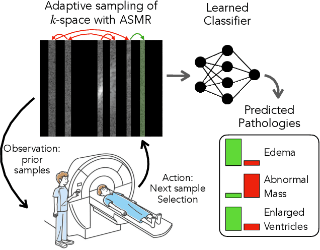 Figure 1 for Adaptive Sampling of k-Space in Magnetic Resonance for Rapid Pathology Prediction