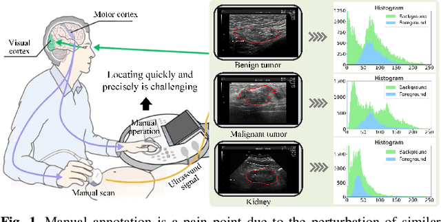 Figure 1 for BAAF: A Benchmark Attention Adaptive Framework for Medical Ultrasound Image Segmentation Tasks