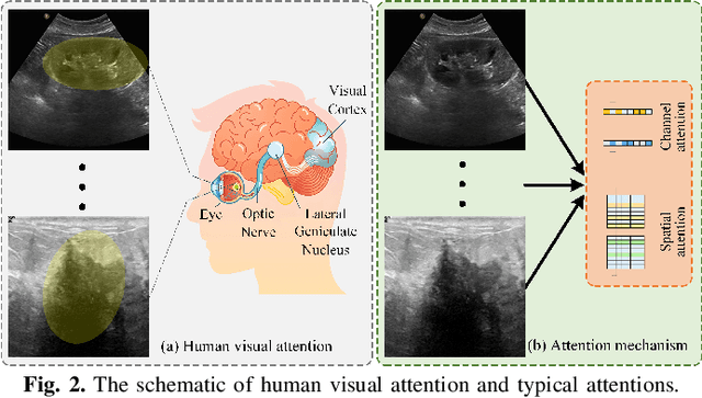 Figure 3 for BAAF: A Benchmark Attention Adaptive Framework for Medical Ultrasound Image Segmentation Tasks