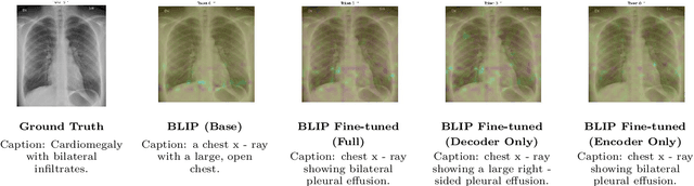 Figure 2 for MedBLIP: Fine-tuning BLIP for Medical Image Captioning