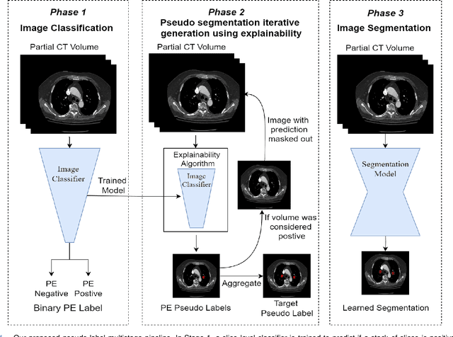 Figure 1 for Label up: Learning Pulmonary Embolism Segmentation from Image Level Annotation through Model Explainability