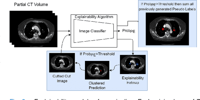 Figure 2 for Label up: Learning Pulmonary Embolism Segmentation from Image Level Annotation through Model Explainability