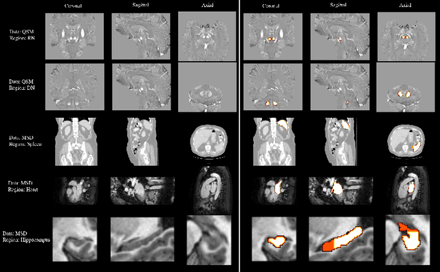 Figure 3 for Frequency Disentangled Learning for Segmentation of Midbrain Structures from Quantitative Susceptibility Mapping Data