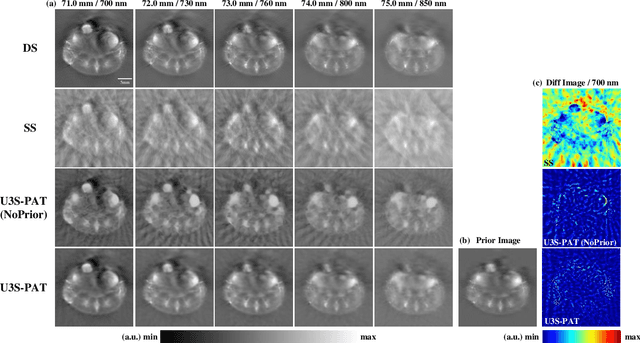 Figure 4 for Spiral Scanning and Self-Supervised Image Reconstruction Enable Ultra-Sparse Sampling Multispectral Photoacoustic Tomography