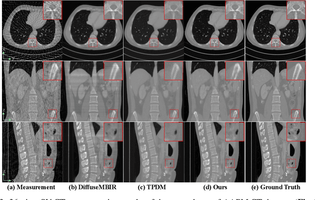 Figure 4 for Blaze3DM: Marry Triplane Representation with Diffusion for 3D Medical Inverse Problem Solving