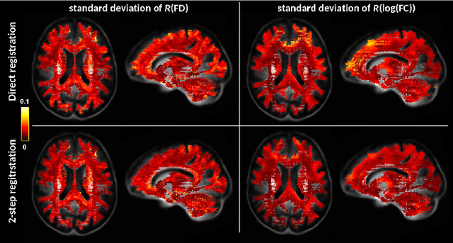 Figure 4 for Two-step registration method boosts sensitivity in longitudinal fixel-based analyses