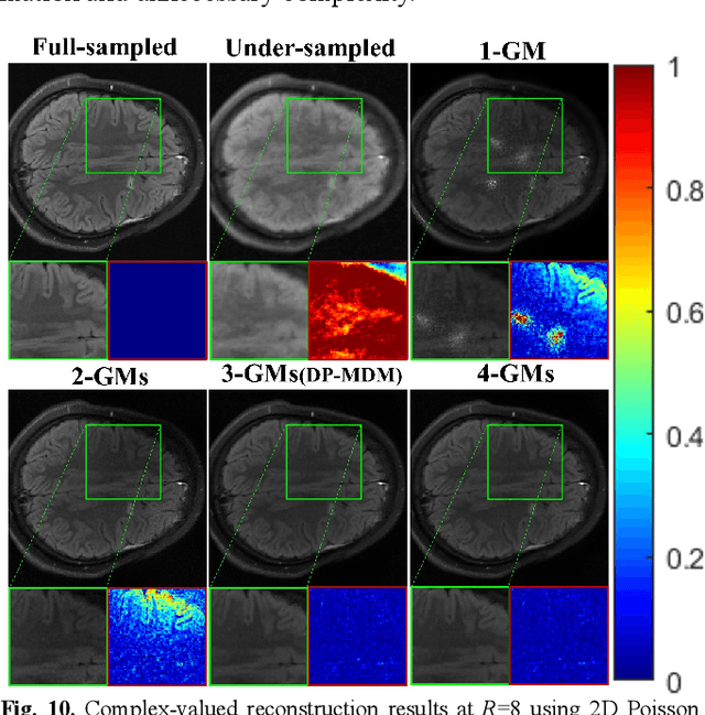 Figure 2 for DP-MDM: Detail-Preserving MR Reconstruction via Multiple Diffusion Models