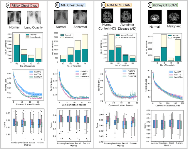 Figure 3 for Federated Hierarchical Tensor Networks: a Collaborative Learning Quantum AI-Driven Framework for Healthcare