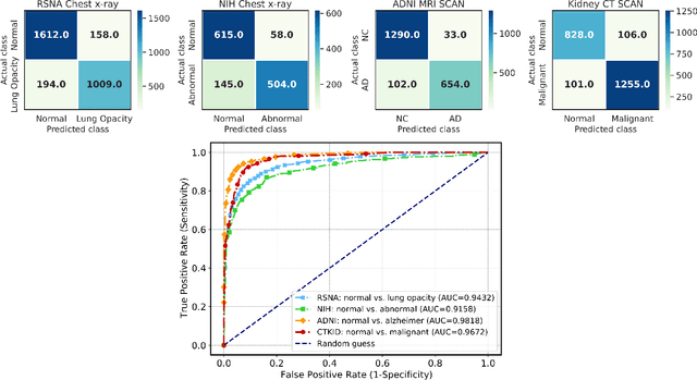 Figure 4 for Federated Hierarchical Tensor Networks: a Collaborative Learning Quantum AI-Driven Framework for Healthcare