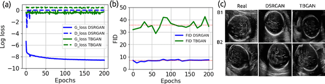 Figure 1 for Towards Realistic Ultrasound Fetal Brain Imaging Synthesis