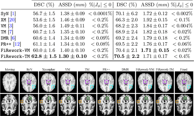Figure 4 for FiRework: Field Refinement Framework for Efficient Enhancement of Deformable Registration