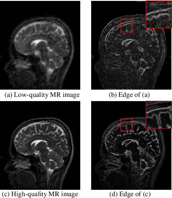 Figure 1 for Joint Edge Optimization Deep Unfolding Network for Accelerated MRI Reconstruction