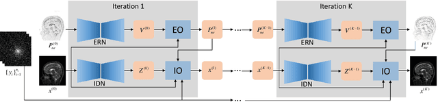 Figure 3 for Joint Edge Optimization Deep Unfolding Network for Accelerated MRI Reconstruction