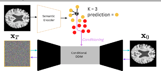 Figure 1 for Interpretable Alzheimer's Disease Classification Via a Contrastive Diffusion Autoencoder