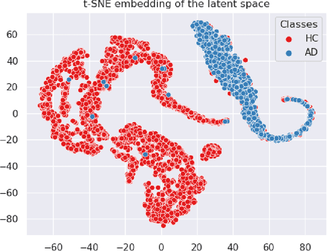 Figure 4 for Interpretable Alzheimer's Disease Classification Via a Contrastive Diffusion Autoencoder