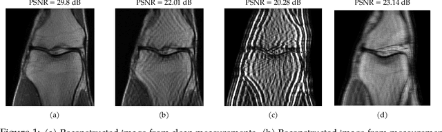 Figure 1 for Diffusion-based Adversarial Purification for Robust Deep MRI Reconstruction