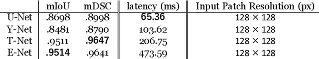 Figure 2 for Lithium Metal Battery Quality Control via Transformer-CNN Segmentation