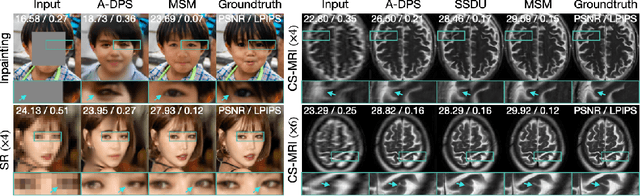 Figure 3 for Measurement Score-Based Diffusion Model