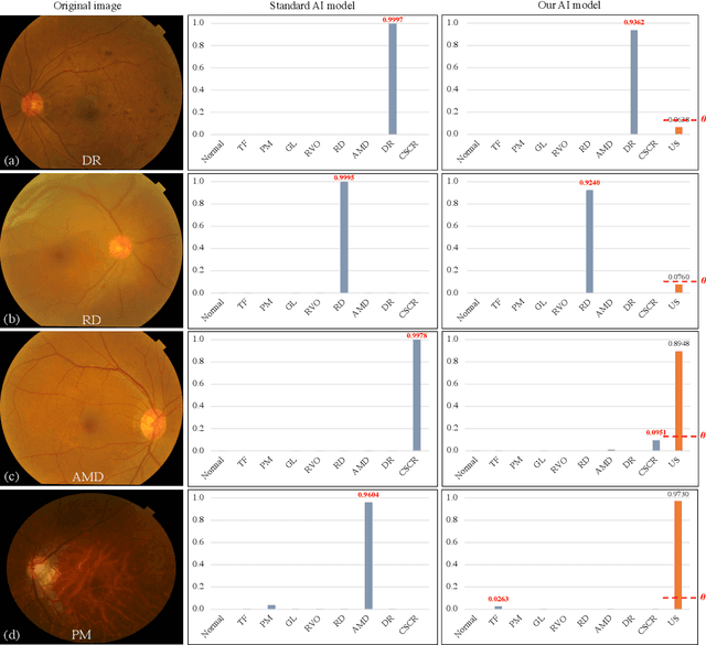 Figure 4 for Uncertainty-inspired Open Set Learning for Retinal Anomaly Identification