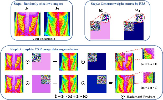 Figure 3 for CMT: Interpretable Model for Rapid Recognition Pneumonia from Chest X-Ray Images by Fusing Low Complexity Multilevel Attention Mechanism