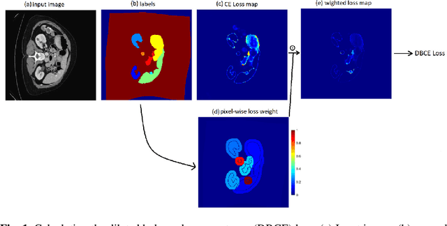 Figure 1 for Dilated Balanced Cross Entropy Loss for Medical Image Segmentation