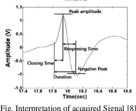 Figure 1 for EOG Communication Interface for Quadriplegics: Prototype & Signal Processing