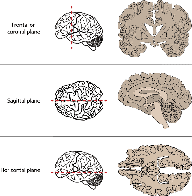 Figure 3 for Efficient Brain Tumor Segmentation Using a Dual-Decoder 3D U-Net with Attention Gates (DDUNet)