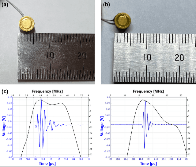 Figure 2 for Deep Learning-based Synthetic High-Resolution In-Depth Imaging Using an Attachable Dual-element Endoscopic Ultrasound Probe