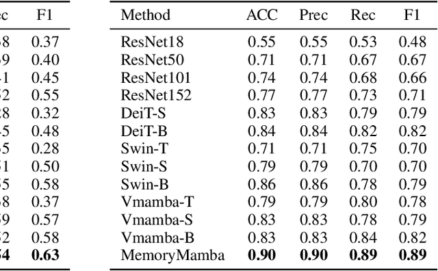 Figure 4 for MemoryMamba: Memory-Augmented State Space Model for Defect Recognition