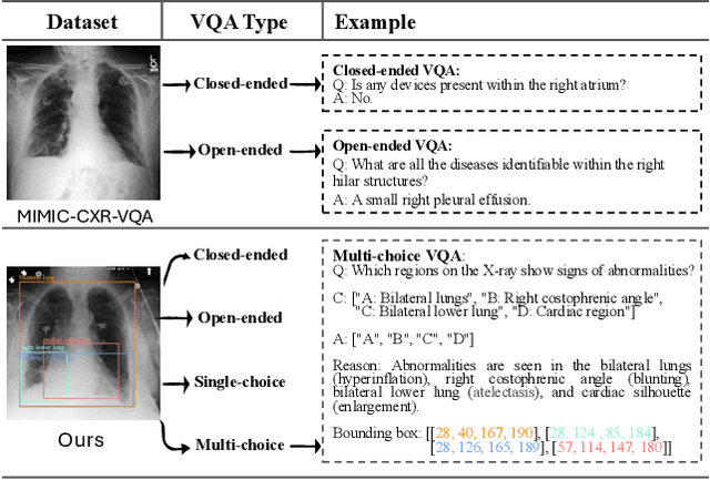 Figure 1 for GEMeX: A Large-Scale, Groundable, and Explainable Medical VQA Benchmark for Chest X-ray Diagnosis