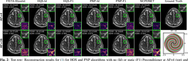 Figure 3 for Robust plug-and-play methods for highly accelerated non-Cartesian MRI reconstruction