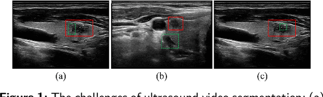 Figure 2 for Tracking spatial temporal details in ultrasound long video via wavelet analysis and memory bank