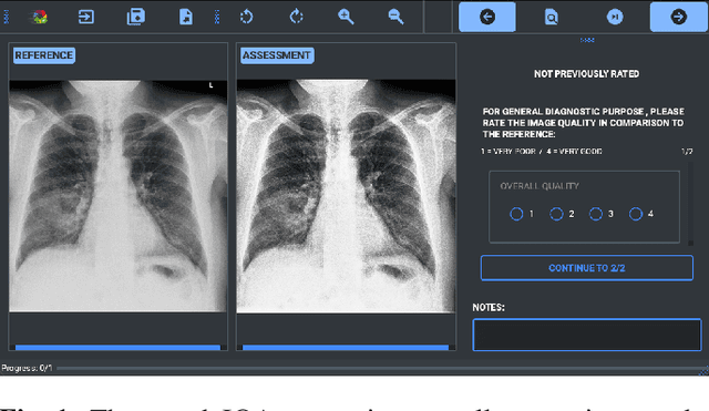 Figure 1 for A study on the adequacy of common IQA measures for medical images