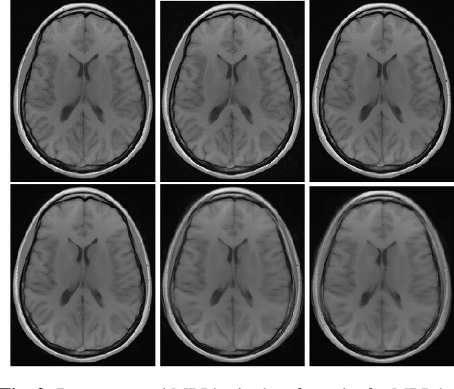 Figure 3 for A study on the adequacy of common IQA measures for medical images