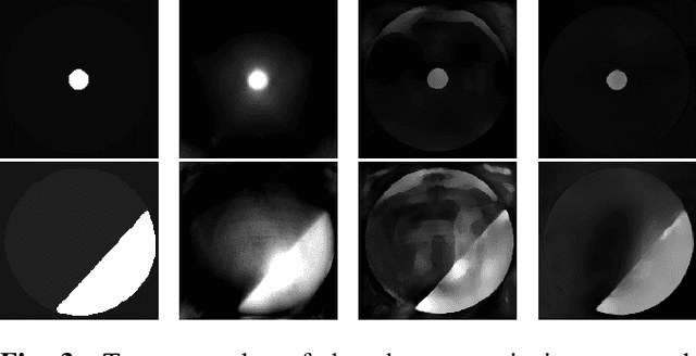 Figure 4 for A study on the adequacy of common IQA measures for medical images