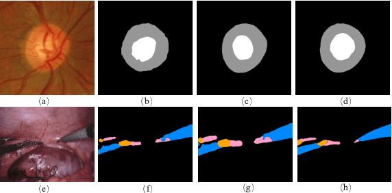 Figure 4 for Imbalanced Medical Image Segmentation with Pixel-dependent Noisy Labels