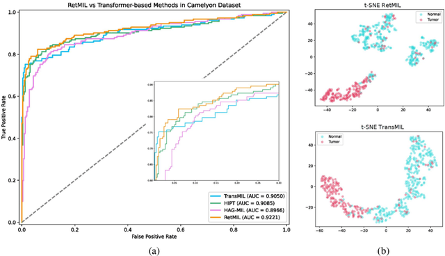 Figure 3 for RetMIL: Retentive Multiple Instance Learning for Histopathological Whole Slide Image Classification