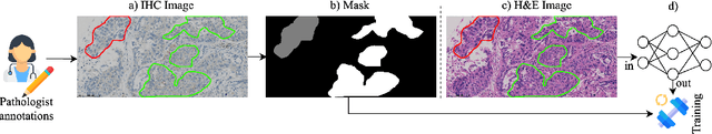 Figure 1 for Multimodal Posterior Sampling-based Uncertainty in PD-L1 Segmentation from H&E Images